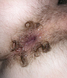 Holes 25 5f5c463666f1c.jpg