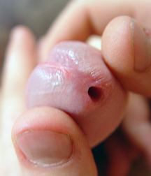Tips & Slits 11 5f9fc4ca07923.jpg