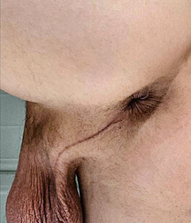 Holes 28 60f3250a273fa.jpg