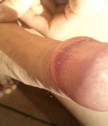 Tre's anatomy 5966833c7f06b.jpg
