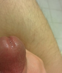 Twink faces cocks and asses 5a30c7157182e.jpeg