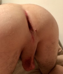 Twink faces cocks and asses 5a30c745ee56f.jpeg