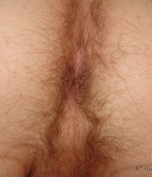 Man 5bfe6402c5a1a.jpg
