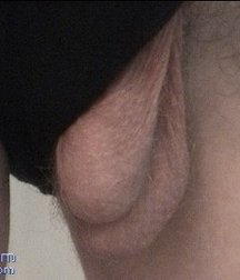 Antosh 5c0cce9889af6.jpg