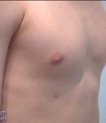 Antosh 5c0ccefdd122f.jpg
