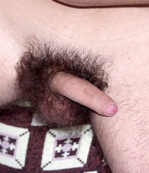 Lexx 5c49a52f10d0c.jpg