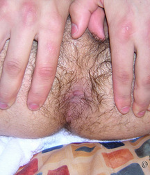 Bommer  5c6140267a2a7.jpg