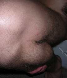 Bommer  5c614184638ba.jpg