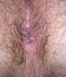 Bommer  5c61425849d1f.jpg