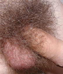 Tolik 5cc94198112fa.jpg