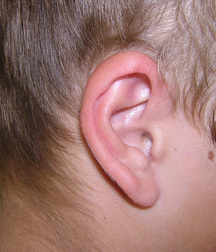 Alin 5cd50bcac3ba5.jpg