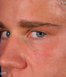 Abel 5d0de5ab73d68.jpg