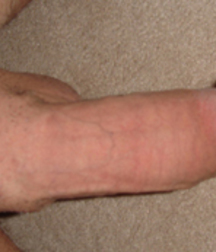 Biebs Penis and a few reds. 57b7c36b4678b.jpg