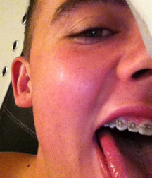 Braces and vampire k-9's 04 5a24c0cb7b69d.jpg