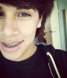 Braces and vampire k-9's 04 5a24c13464854.jpg