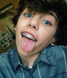 Braces and vampire k-9's 04 5a24c139c648b.jpg