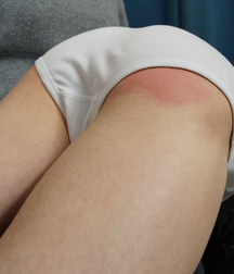 Nice spanked boy 59d5528fa5346.jpg