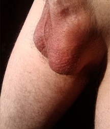 Just Balls 57ba4a7ee7368.jpg