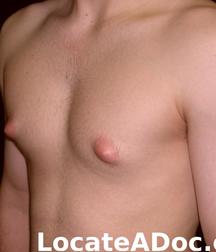 Boys Nips 57dafd328c11f.jpg
