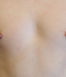 Boys Nips 57dafd468c46f.jpg