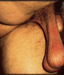 A Look at Guys Balls 5821c19580bd9.png
