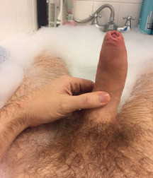 The Uncut Penis 58677f08e1297.jpg