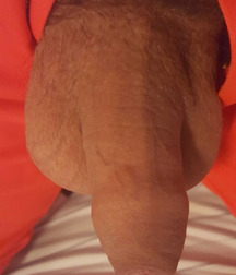 The Uncut Penis 58677fa1e7441.jpg