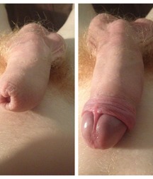 Uncut Boy Cock Yum!