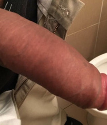 Just Dick! 58c763b3e37f4.jpg