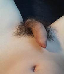 Long Foreskin Hnaging Over Tips 58ddd7eda9e99.jpg