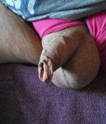 Long Foreskin Hnaging Over Tips 58ddd8159db43.jpg