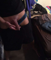 Long Foreskin Hnaging Over Tips 58ddd8193cc7a.jpg