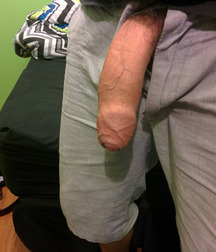 Big, Bigger and Biggest! 593cb8026d6c2.jpg