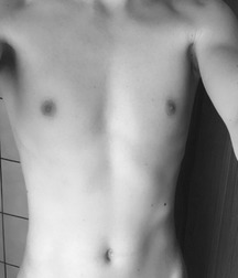 Skins 5b4297c53d266.jpg