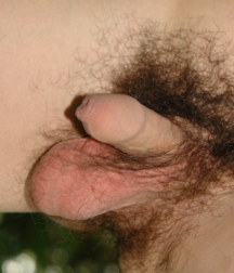 Boys Naked Outside 5b79c5b156f1d.png