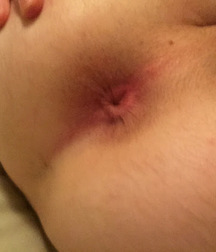 Naked Teen Boys 5b821012025ba.jpg