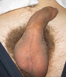 Shaggy Extra Long Foreskins 5b8c5bac2c7ac.jpg