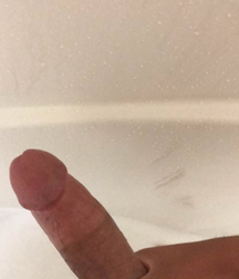 A Study of Male Dicks 5bdf7c131808b.png