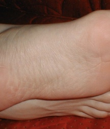 Naked Feet! My First Foot Upload! 5ee17a6761b45.jpeg