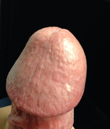 Helmet Head Cocks - Flared, Defined Heads - Unique 6069182d687ea.jpg