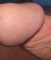 Helmet Head Cocks - Flared, Defined Heads - Unique 6069183eb2b7c.jpg